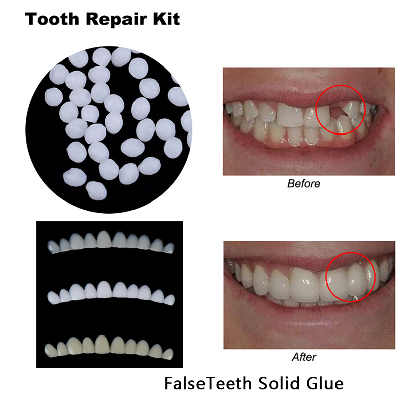 Teeth Whitening Kit - Temporary Tooth Repair Kit Teeth Gaps