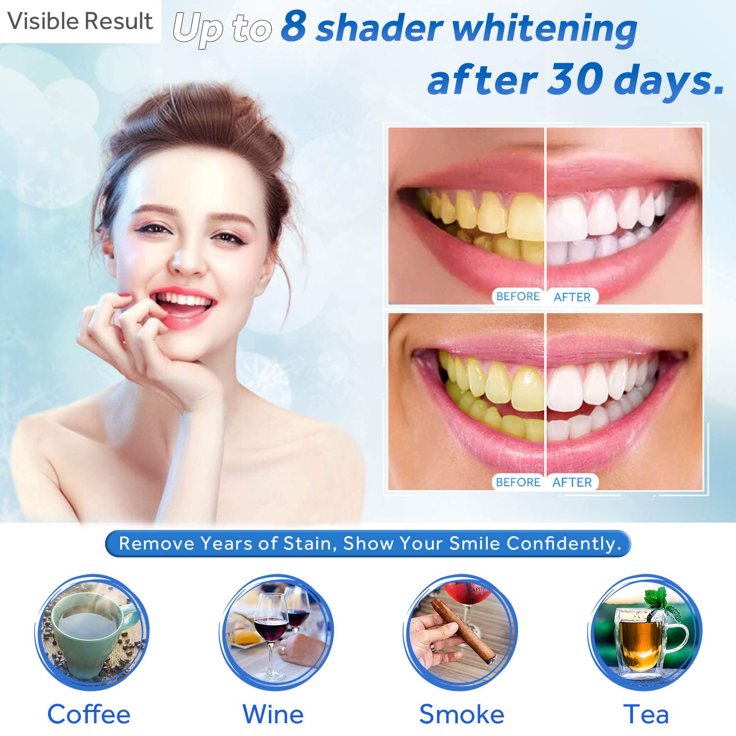 Teeth Whitening Gel Refill Syr - Teeth Whitening Near Me 评论和价格