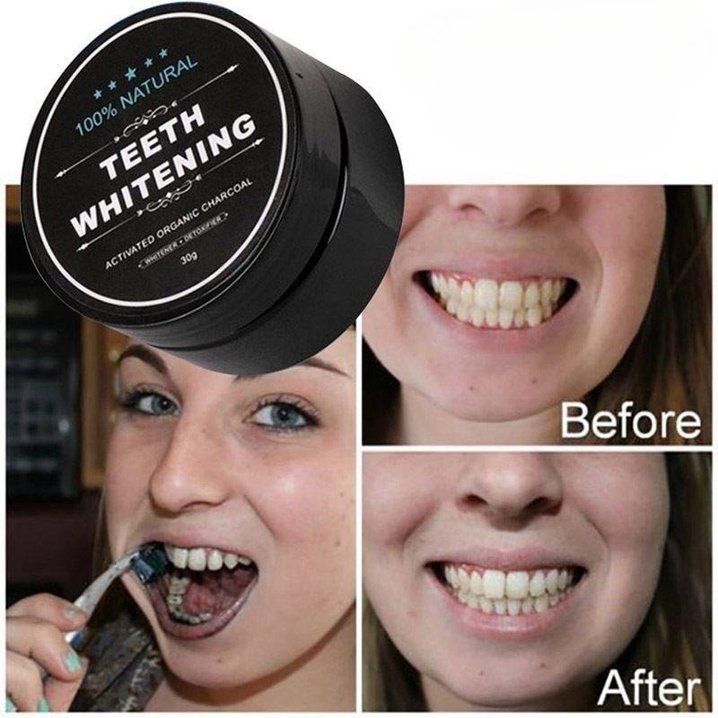 1 Box Activated Charcoal Teeth - Teeth Whitening Near Me 评论和价格