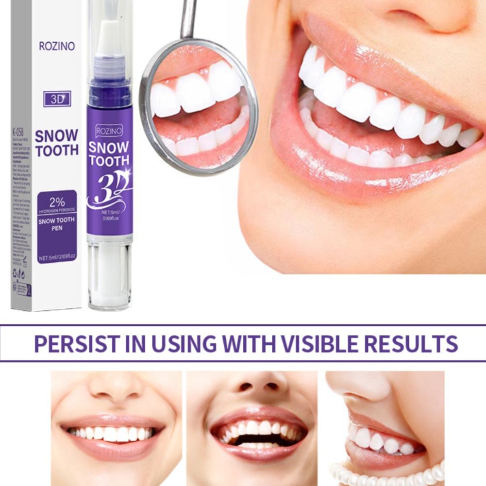 Portable Teeth Whitening Pen E - Teeth Whitening Pens 评论和价格